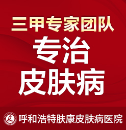 呼和浩特哪个医院治疗荨麻疹专业_荨麻疹发病原因有什么因素