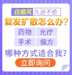 治疗白斑怎样做好?西安白癜风好的医院