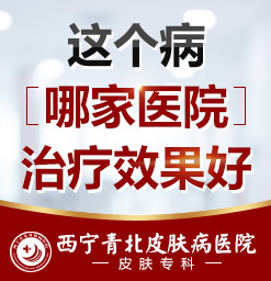 西宁去哪个皮肤病医院好_西宁看皮肤病去哪