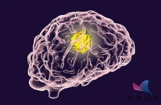 益阳着名癫痫专业医院 益阳治复发性癫痫有什么医院