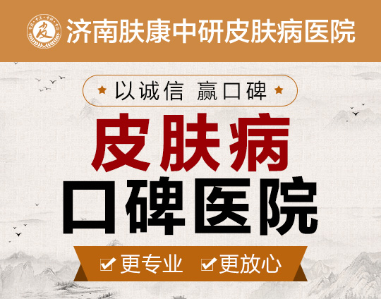 济南看皮肤病去哪家医院比较好_济南皮肤科去哪个医院好