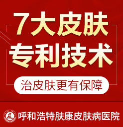 呼和浩特专业治疗过敏性皮炎医院_呼市湿疹治疗医院哪家好