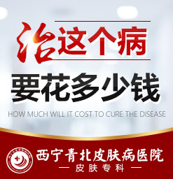 西宁治疗荨麻疹较好的专科医院_西宁哪个医院治荨麻疹好