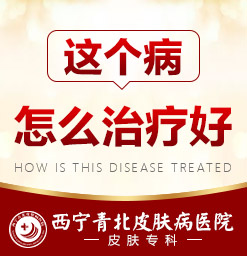 西宁哪家医院治疗胎记好_西宁治胎记比较好的医院