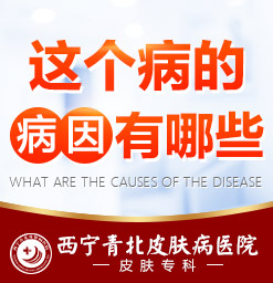 西宁哪家医院治疗皮肤病较好_西宁治疗皮肤病较好的医院