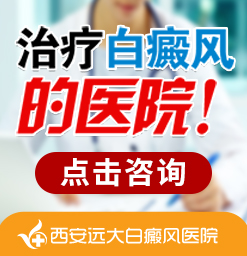 白癜风的预防知识是什么?西安白癜风医院