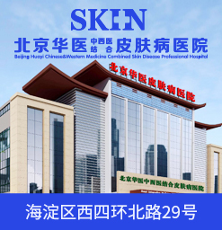 牛皮癣能治好吗?牛皮癣的五大诱因要小心了.