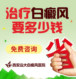 夏季白癜风患者对于饮食需要注意什么?陕西白癜风医院地址