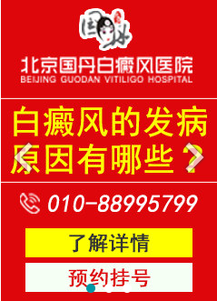 临床上面对白癜风是怎样分类的？