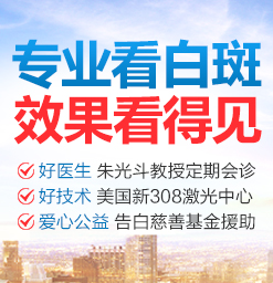 面部白癜风有哪些症状？