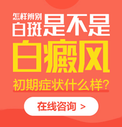 白斑饮食禁忌有那些 济南白癜风医院怎么治白癜风