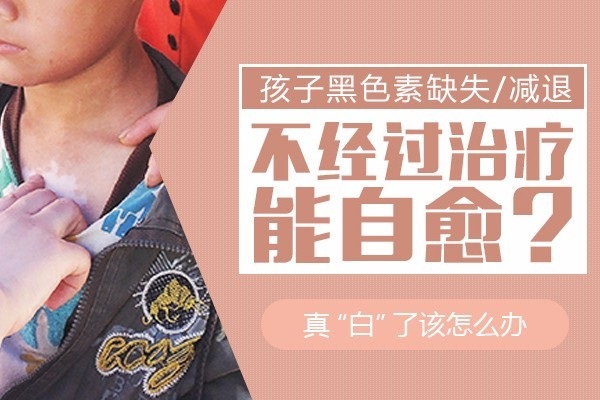 白癜风怎么控制扩散 济南看白癜风专科医院