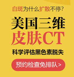 杭州白癜风医院适合护理的方法有哪些呢?