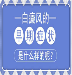 南京市治疗白癜风医院怎么样？预防白斑的方法是什么