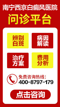 柳州治疗儿童白癜风医院