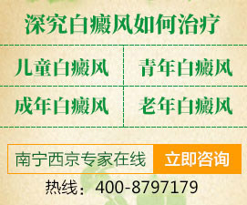 钦州专看白癜风医院，白癜风患者不能吃什么