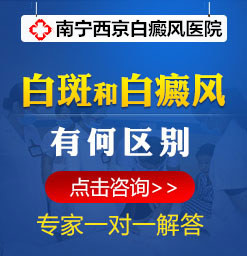 贺州白癜风治疗医院哪里专业?白癜风诊断方法有哪些