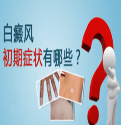 南京看白癜风什么医院？白斑的心理问题怎么治疗