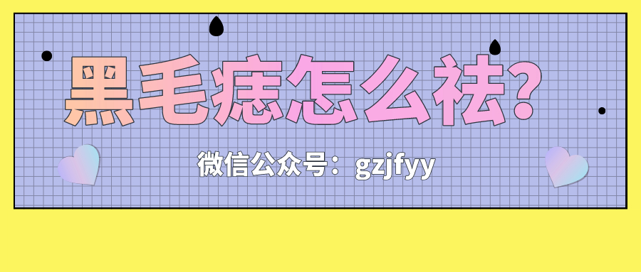 广州哪个医院能做黑毛痣?